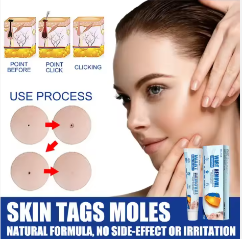 ELLHOE®  OFERTA 2X1 Crema Removedor De Lunares Y Verrugas 3ml | Paga uno recibe 2 Pago Contra entrega y Envío Gratis en Panamá!