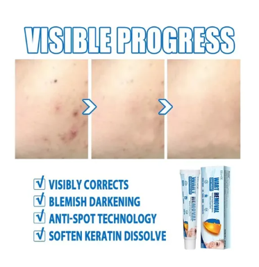 ELLHOE®  OFERTA 2X1 Crema Removedor De Lunares Y Verrugas 3ml | Paga uno recibe 2 Pago Contra entrega y Envío Gratis en Panamá!