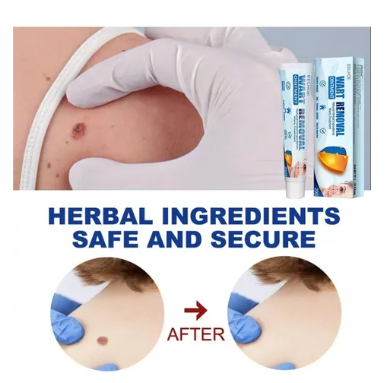 ELLHOE®  OFERTA 2X1 Crema Removedor De Lunares Y Verrugas 3ml | Paga uno recibe 2 Pago Contra entrega y Envío Gratis en Panamá!