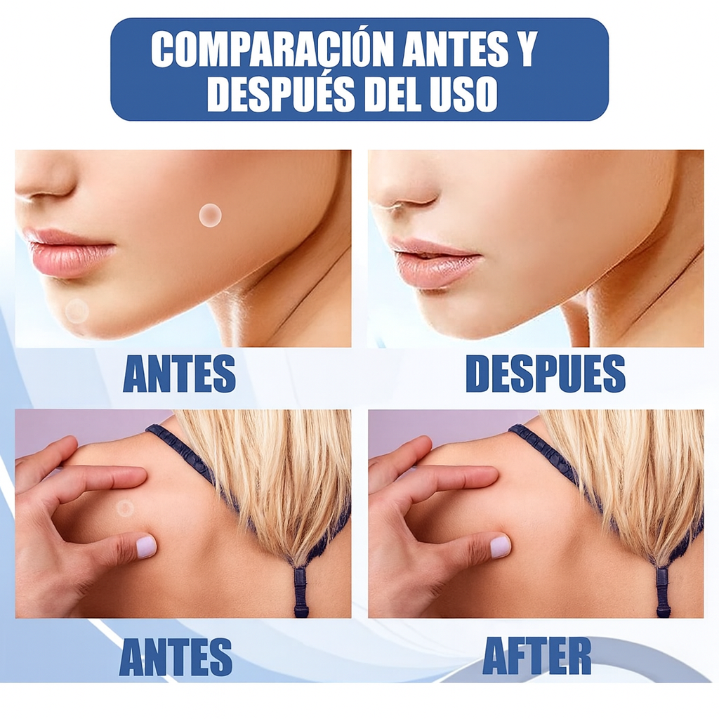 🌿 EELHOE Parches Naturales para Eliminar Verrugas y Lunares – 144 Piezas... PAGO CONTRA ENTREGA Y ENVIÓ GRATIS EN PANAMÁ...