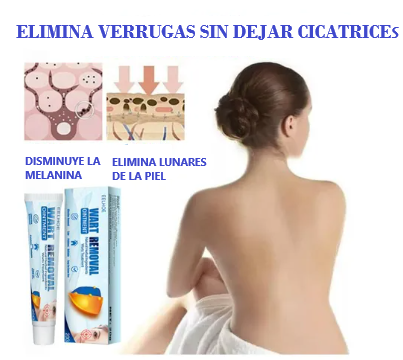 ELLHOE®  OFERTA 2X1 Crema Removedor De Lunares Y Verrugas 3ml | Paga uno recibe 2 Pago Contra entrega y Envío Gratis en Panamá!