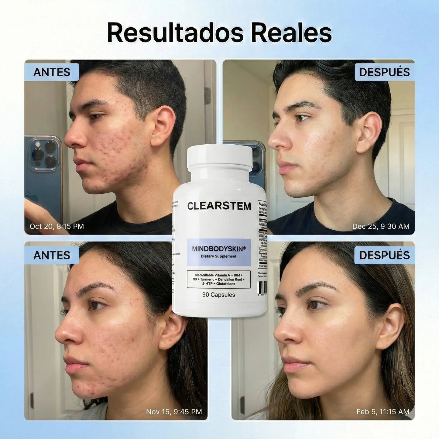 (55% DESCUENTO) Clearstem™ | Fórmula Avanzada para el Equilibrio de la Piel y Control de Brotes