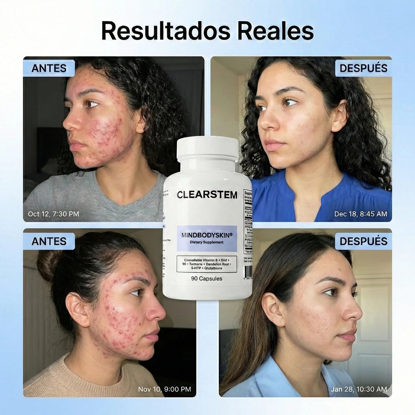 (55% DESCUENTO) Clearstem™ | Fórmula Avanzada para el Equilibrio de la Piel y Control de Brotes