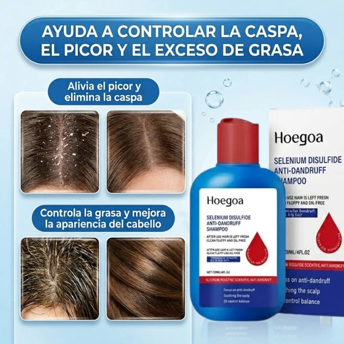 (2x1) Shampoo Anticaspa Viral™ | Limpieza Profunda + Menos Picazón