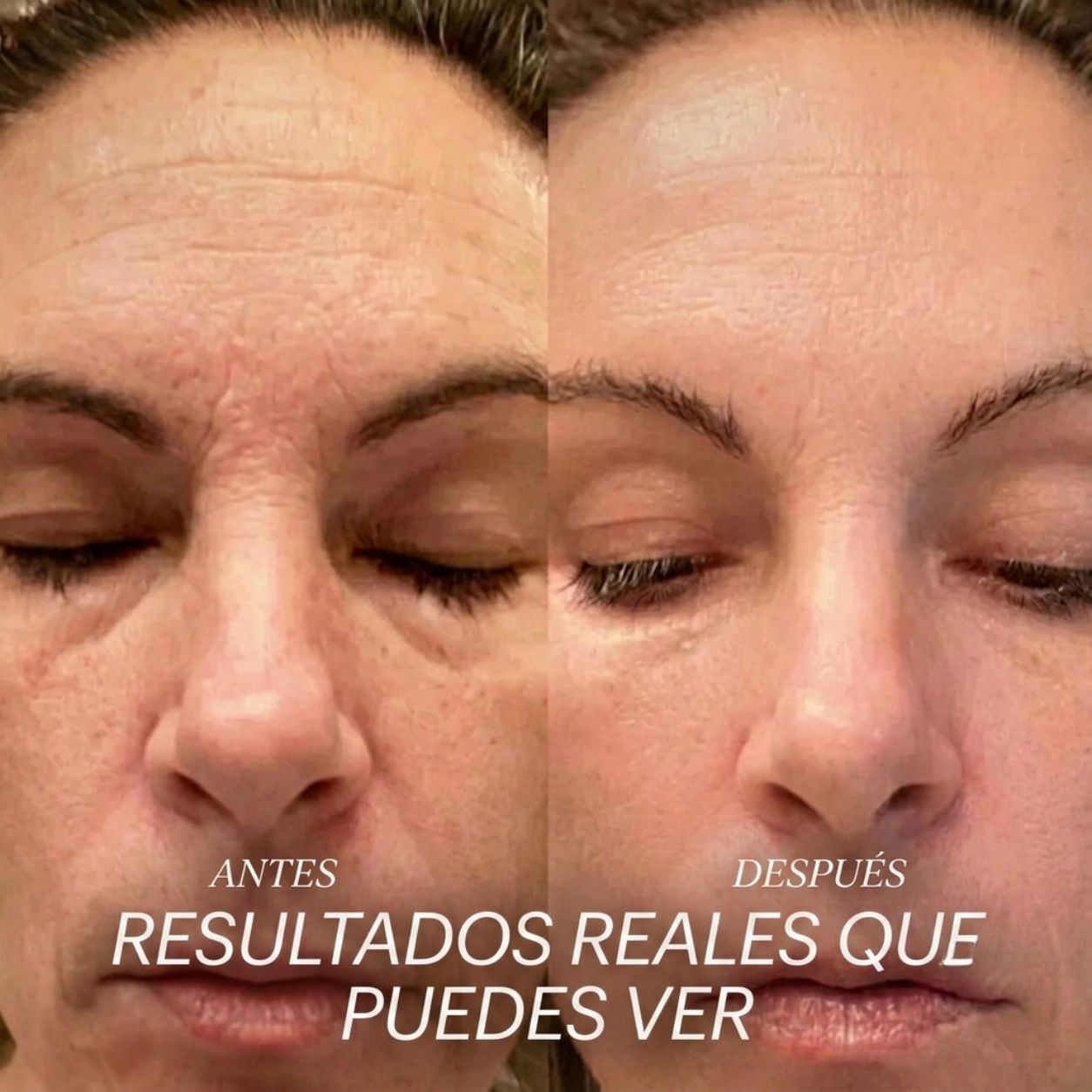 (55% Descuento) NMN Complex™ | Antienvejecimiento y Vitalidad