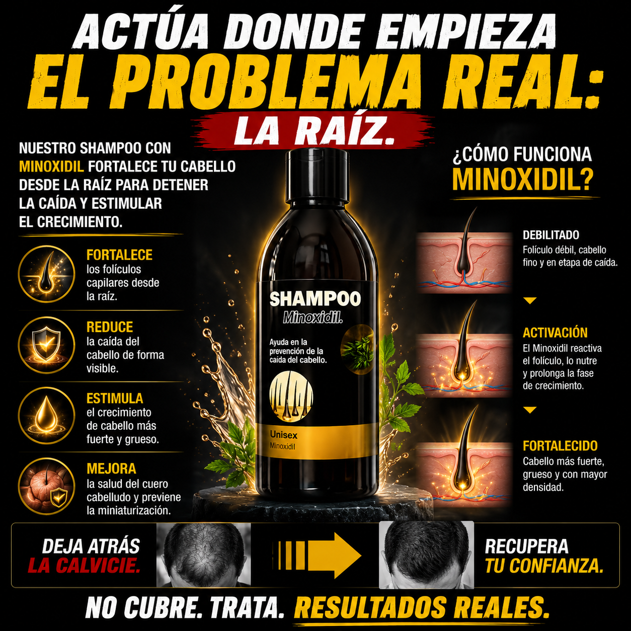 (67% Descuento) Shampoo Minoxidil Original| Crecimiento Capilar + Mayor Volumen