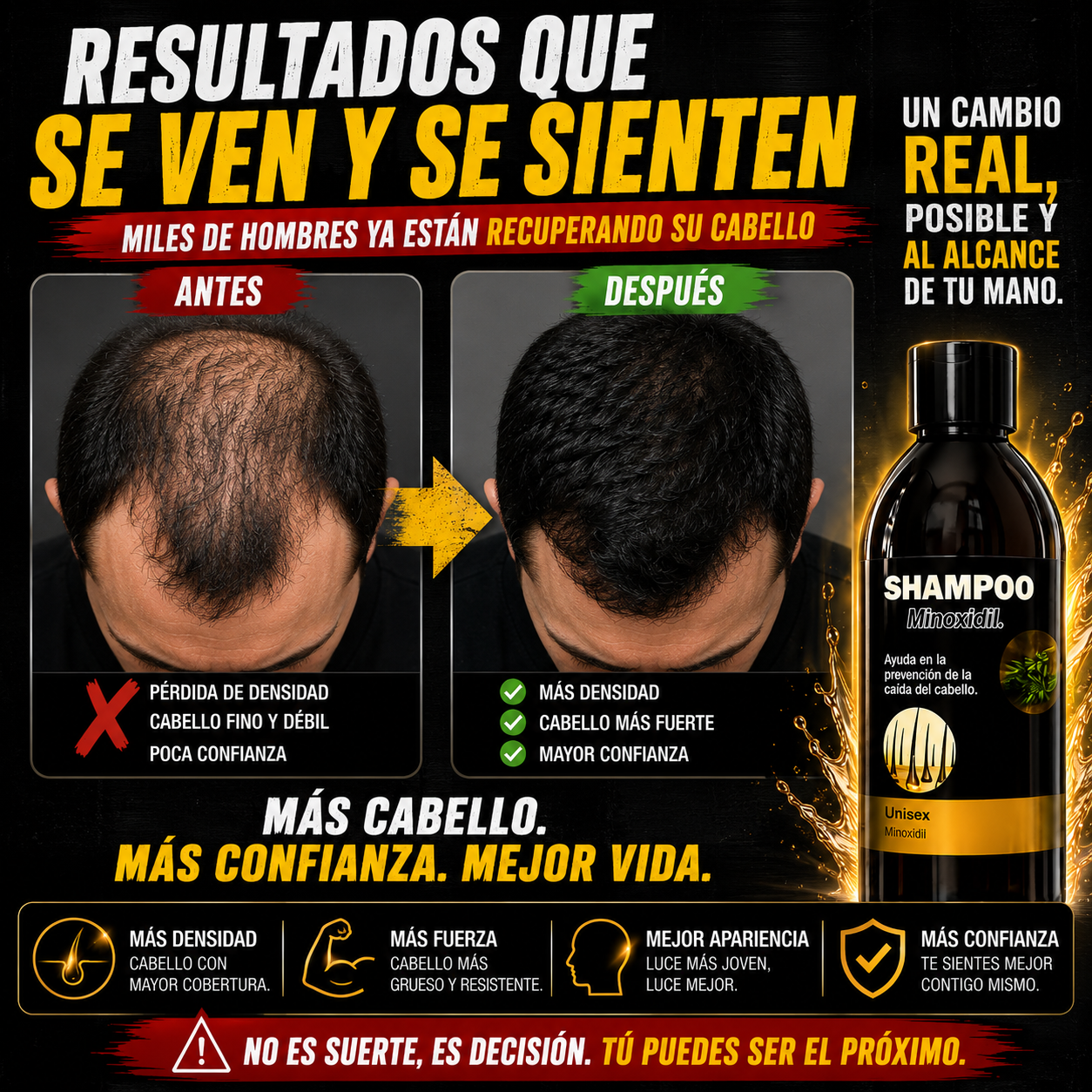 (67% Descuento) Shampoo Minoxidil Original| Crecimiento Capilar + Mayor Volumen