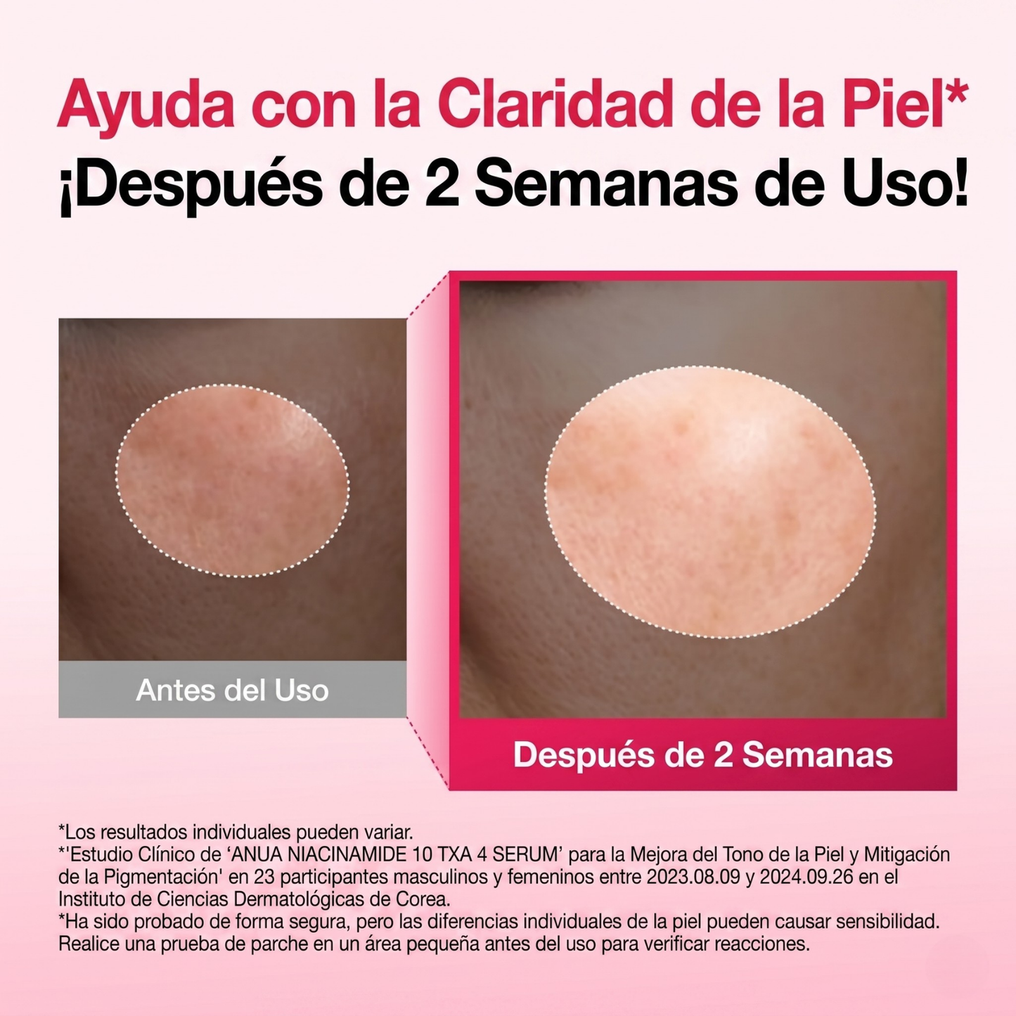 ANUA™ Niacinamida 10% + TXA 4% Sérum | Máxima Luminosidad + Corrección de Manchas