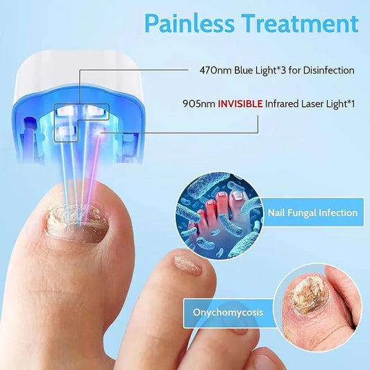 Lisor®  Dispositivo Laser Eliminador de Hongos en 2 semanas