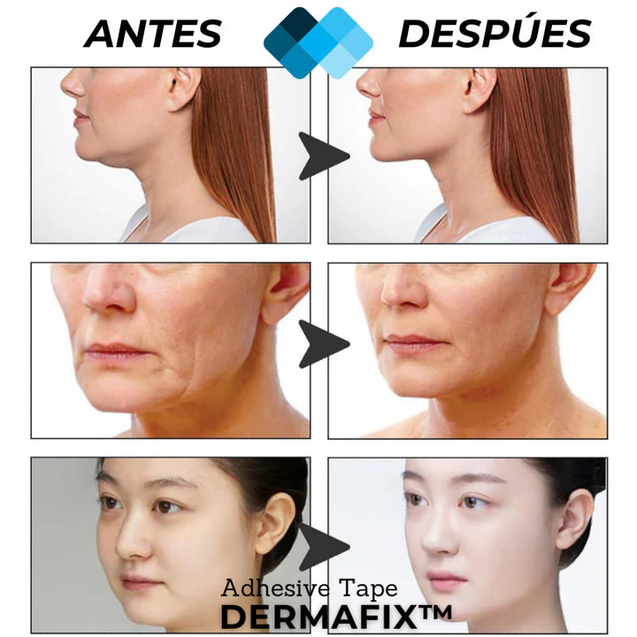 (PACK 40 Unidades Reutilizables) Tiras de Lifting facial efecto Natural "Buena Cara" l BeautySide™